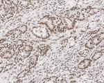 MNAR Antibody in Immunohistochemistry (Paraffin) (IHC (P))