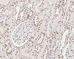 MNAR Antibody in Immunohistochemistry (Paraffin) (IHC (P))