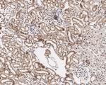 MNAR Antibody in Immunohistochemistry (Paraffin) (IHC (P))