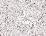 MNAR Antibody in Immunohistochemistry (Paraffin) (IHC (P))