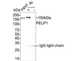 MNAR Antibody in Immunoprecipitation (IP)