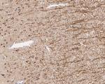 Amyloid Precursor Protein Antibody in Immunohistochemistry (Paraffin) (IHC (P))
