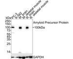Amyloid Precursor Protein Antibody in Western Blot (WB)