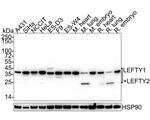 Lefty1/Lefty2 Recombinant Rabbit Monoclonal Antibody (JE38-88)