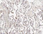 PMCA1 ATPase Antibody in Immunohistochemistry (Paraffin) (IHC (P))