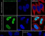 H3K27M Recombinant Rabbit Monoclonal Antibody (JE46-51)