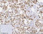 H3K27M Antibody in Immunohistochemistry (Paraffin) (IHC (P))