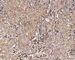 GRP78 Recombinant Rabbit Monoclonal Antibody (JE01-35)