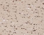 GRP78 Antibody in Immunohistochemistry (Paraffin) (IHC (P))