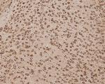 GRP78 Antibody in Immunohistochemistry (Paraffin) (IHC (P))