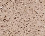 GRP78 Antibody in Immunohistochemistry (Paraffin) (IHC (P))
