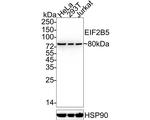 eIF2b epsilon Antibody in Western Blot (WB)