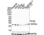 GTF2B Recombinant Rabbit Monoclonal Antibody (JE38-37)