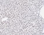 RAD23A Antibody in Immunohistochemistry (Paraffin) (IHC (P))