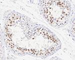 GMNN Antibody in Immunohistochemistry (Paraffin) (IHC (P))