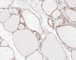 CRABP1 Antibody in Immunohistochemistry (Paraffin) (IHC (P))