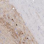 CRABP1 Antibody in Immunohistochemistry (Paraffin) (IHC (P))