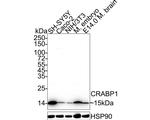 CRABP1 Antibody in Western Blot (WB)