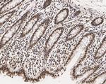 Lamin A/C Antibody in Immunohistochemistry (Paraffin) (IHC (P))