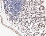 Lamin A/C Antibody in Immunohistochemistry (Paraffin) (IHC (P))