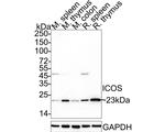 ICOS (CD278) Antibody in Western Blot (WB)