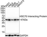 HIP Antibody in Western Blot (WB)