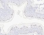 DLX3 Antibody in Immunohistochemistry (Paraffin) (IHC (P))