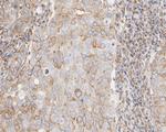 TUBB1 Antibody in Immunohistochemistry (Paraffin) (IHC (P))