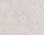 TUBB1 Antibody in Immunohistochemistry (Paraffin) (IHC (P))