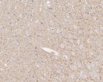 TUBB1 Antibody in Immunohistochemistry (Paraffin) (IHC (P))