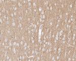 TUBB1 Antibody in Immunohistochemistry (Paraffin) (IHC (P))