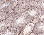 CBP Antibody in Immunohistochemistry (Paraffin) (IHC (P))