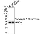 AZGP1 Recombinant Rabbit Monoclonal Antibody (JE35-38)