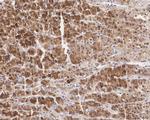 INHA Antibody in Immunohistochemistry (Paraffin) (IHC (P))