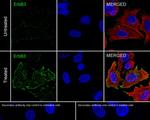 Phospho-ErbB3 (Tyr1289) Recombinant Rabbit Monoclonal Antibody (JE51-25)