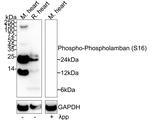 Phospho-Phospholamban (Ser16) Recombinant Rabbit Monoclonal Antibody (JE47-45)