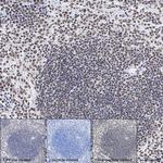 Phospho-AKT1/AKT2/AKT3 (Ser473) Antibody in Immunohistochemistry (Paraffin) (IHC (P))