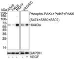 Phospho-PAK4/6/7 (Ser474, Ser602, Ser560) Recombinant Rabbit Monoclonal Antibody (JE57-42)
