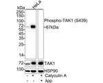 Phospho-TAK1 (Ser439) Antibody in Western Blot (WB)