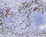 Phospho-CDK1/CDK2/CDK3 (Thr14) Antibody in Immunohistochemistry (Paraffin) (IHC (P))