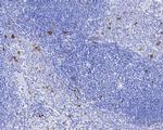 Phospho-CDK1/CDK2/CDK3 (Thr14) Antibody in Immunohistochemistry (Paraffin) (IHC (P))