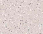 Phospho-Tau (Thr181) Antibody in Immunohistochemistry (Paraffin) (IHC (P))