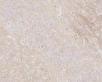 Phospho-Tau (Thr181) Antibody in Immunohistochemistry (Paraffin) (IHC (P))