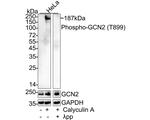 Phospho-GCN2 (Thr899) Recombinant Rabbit Monoclonal Antibody (JE00-51)