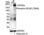 Phospho-GCN2 (Thr899) Antibody in Western Blot (WB)