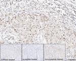 Phospho-p38 MAPK (Thr180) Antibody in Immunohistochemistry (Paraffin) (IHC (P))