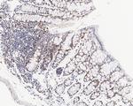 Phospho-p38 MAPK (Thr180) Antibody in Immunohistochemistry (Paraffin) (IHC (P))