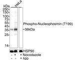 Phospho-NPM1 (Thr199) Antibody in Western Blot (WB)