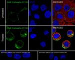 Phospho-ErbB2 (HER-2) (Tyr1139) Antibody in Immunocytochemistry (ICC/IF)