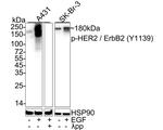 Phospho-ErbB2 (HER-2) (Tyr1139) Antibody in Western Blot (WB)